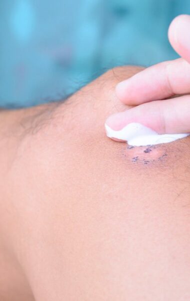 Crema pentru cicatrici: ce trebuie să obții în urma utilizării?