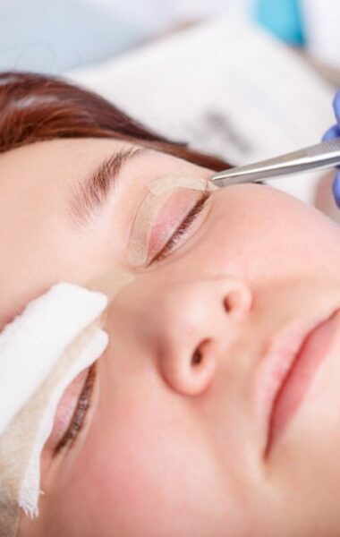 The scar cream can be used after eyelid surgery